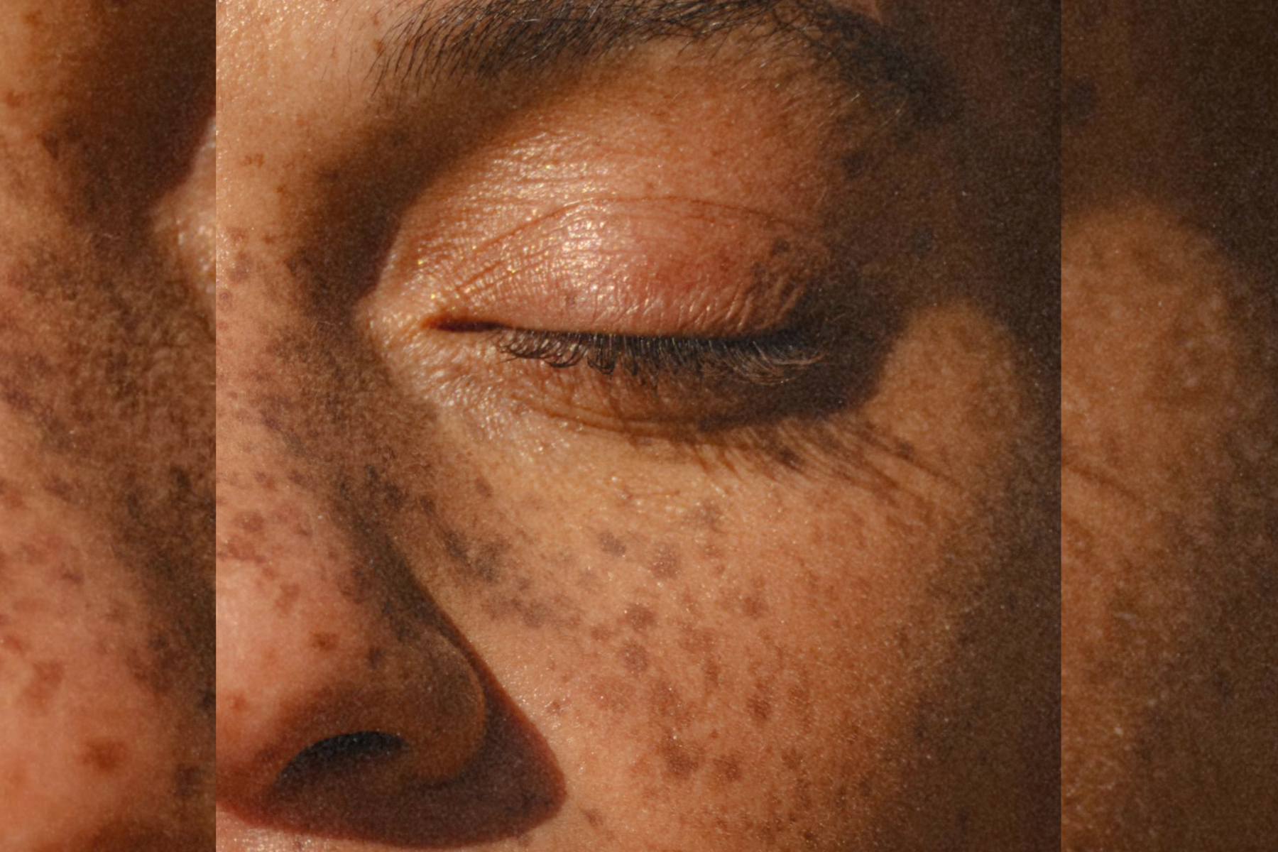Close-up of a person’s face with their eyes closed, showing freckles and natural skin texture.
