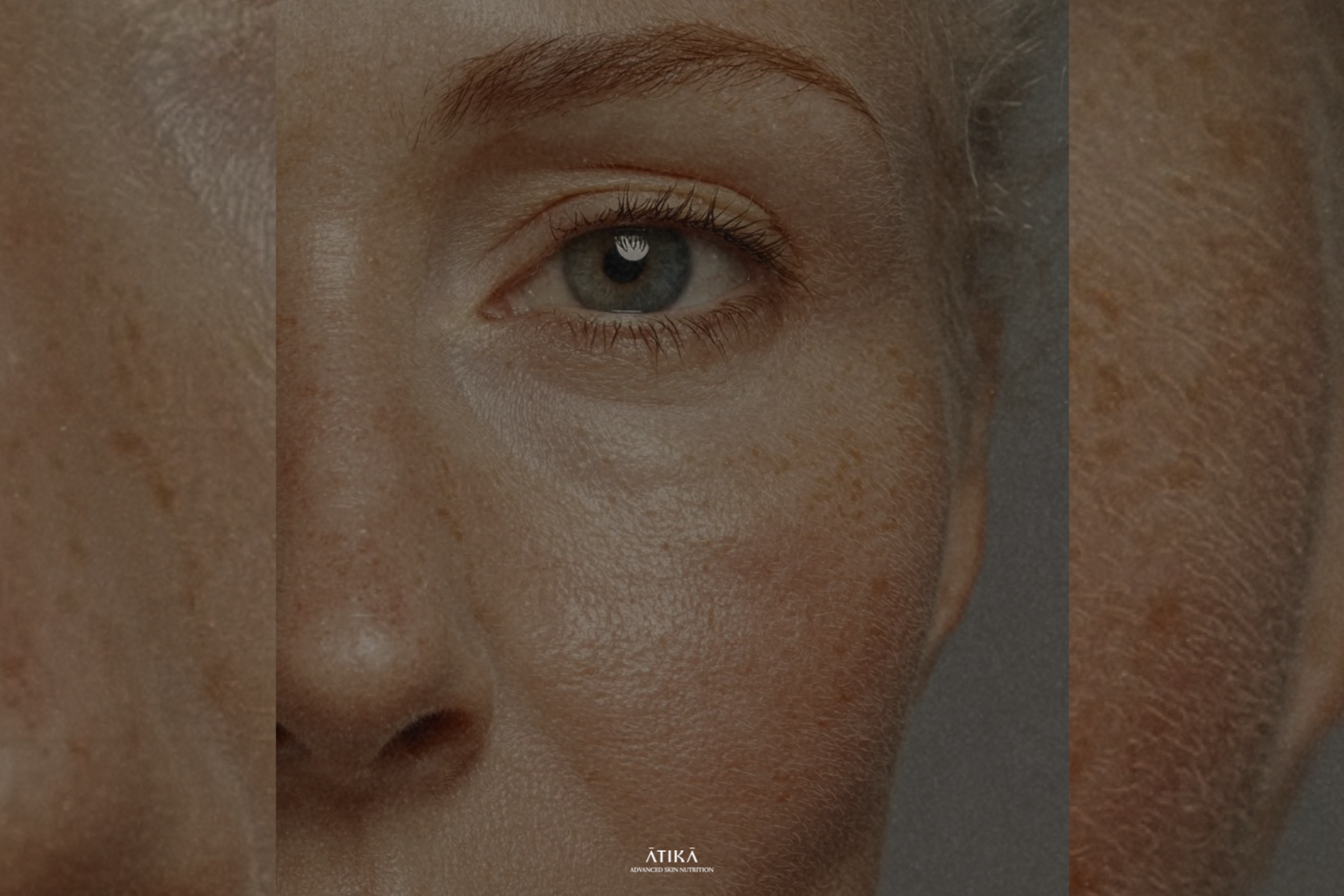 Close-up of facial skin showing natural texture, pores, and pigmentation.