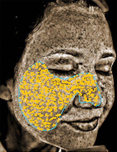 Age 45: UV Spots