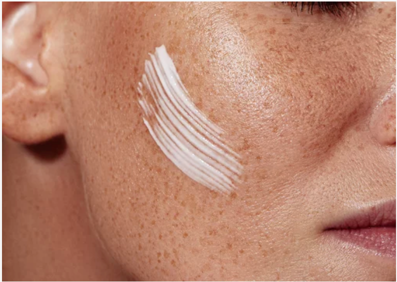 Close-up of a woman’s cheek with visible freckles and natural skin texture, featuring a single swipe of white cream applied to the skin.